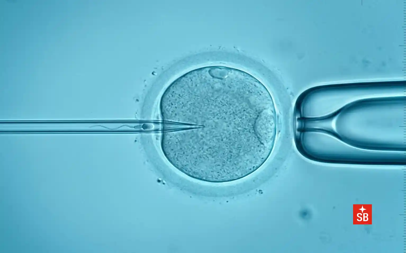 Intracytoplasmic Sperm Injection (ICSI) under an inverted light microscope