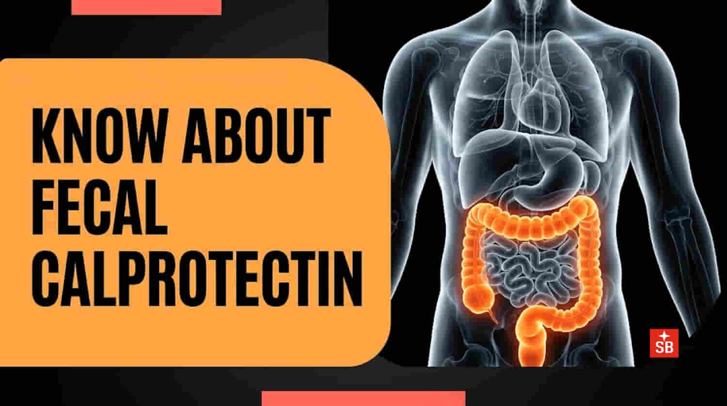 Stool calprotectin the silent gut alarm that spots inflammation before symptoms worsen