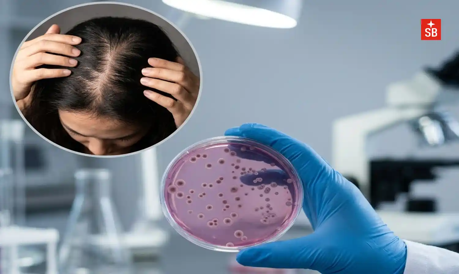 The fungal pathogen Candida auris exposes chitin to trigger IFNγ and persist in hair follicles