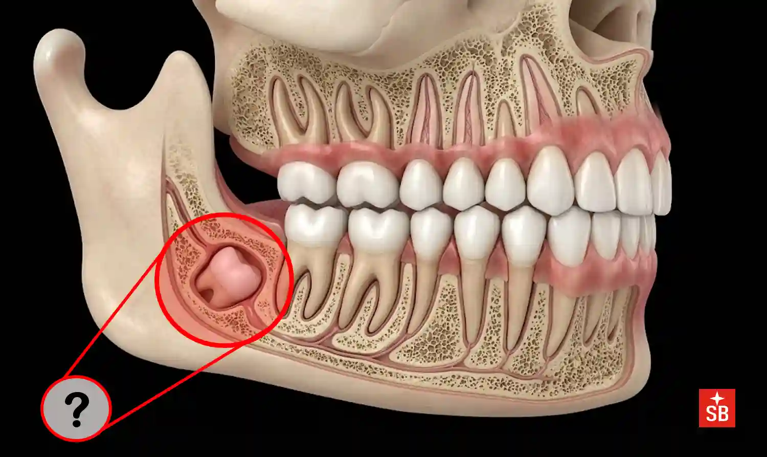 Why do we lose baby teeth but never grow a third set