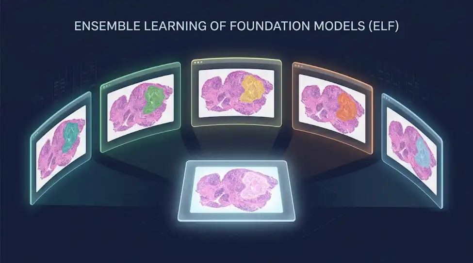 Five AI models walk into a pathology lab: Stanford's "committee" approach beats every single one