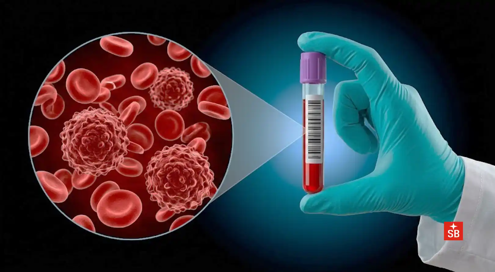 How multi-cancer early detection is rewriting oncology