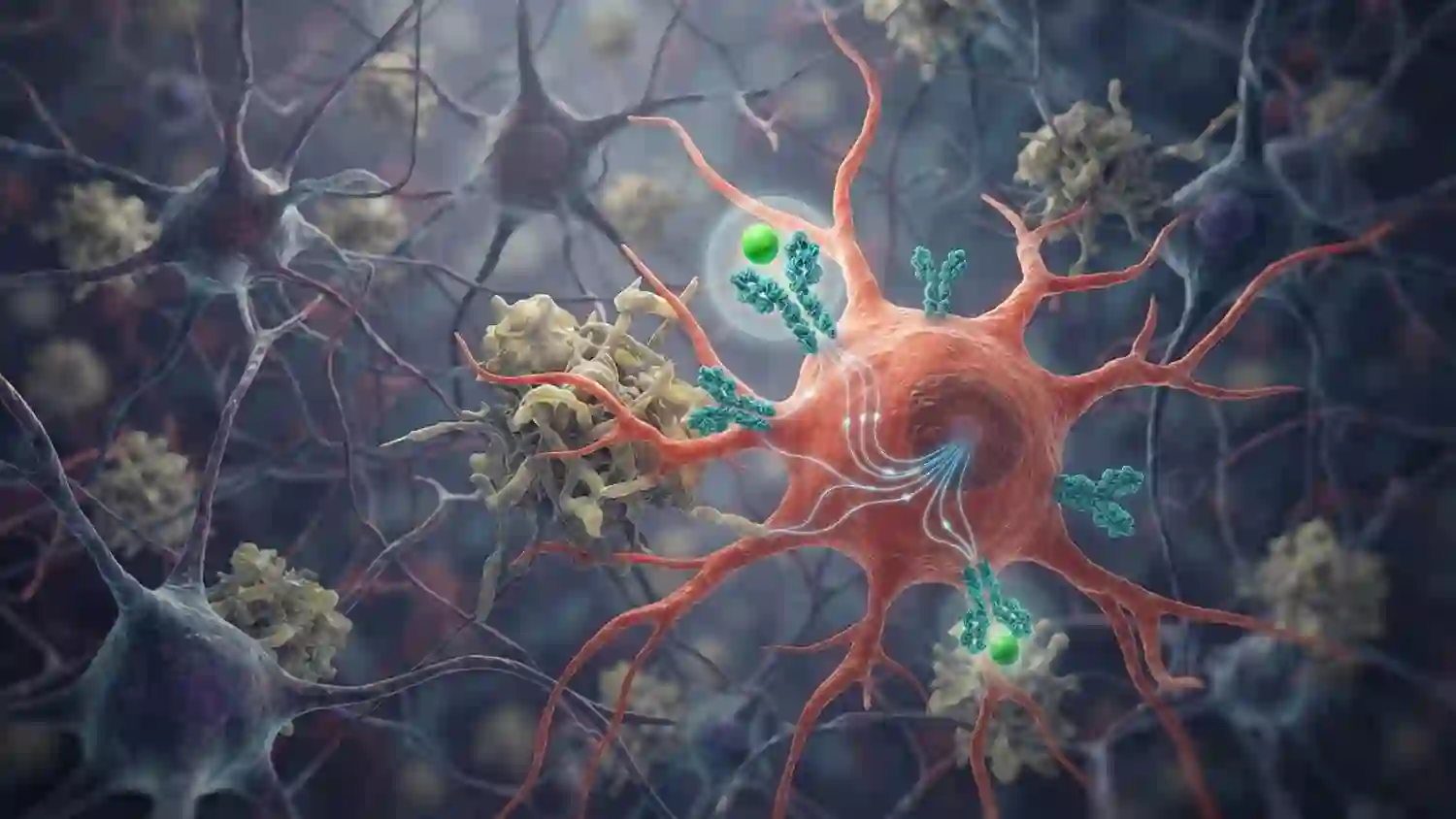 Human brain tissue points to a new target for Alzheimer’s neuroinflammation